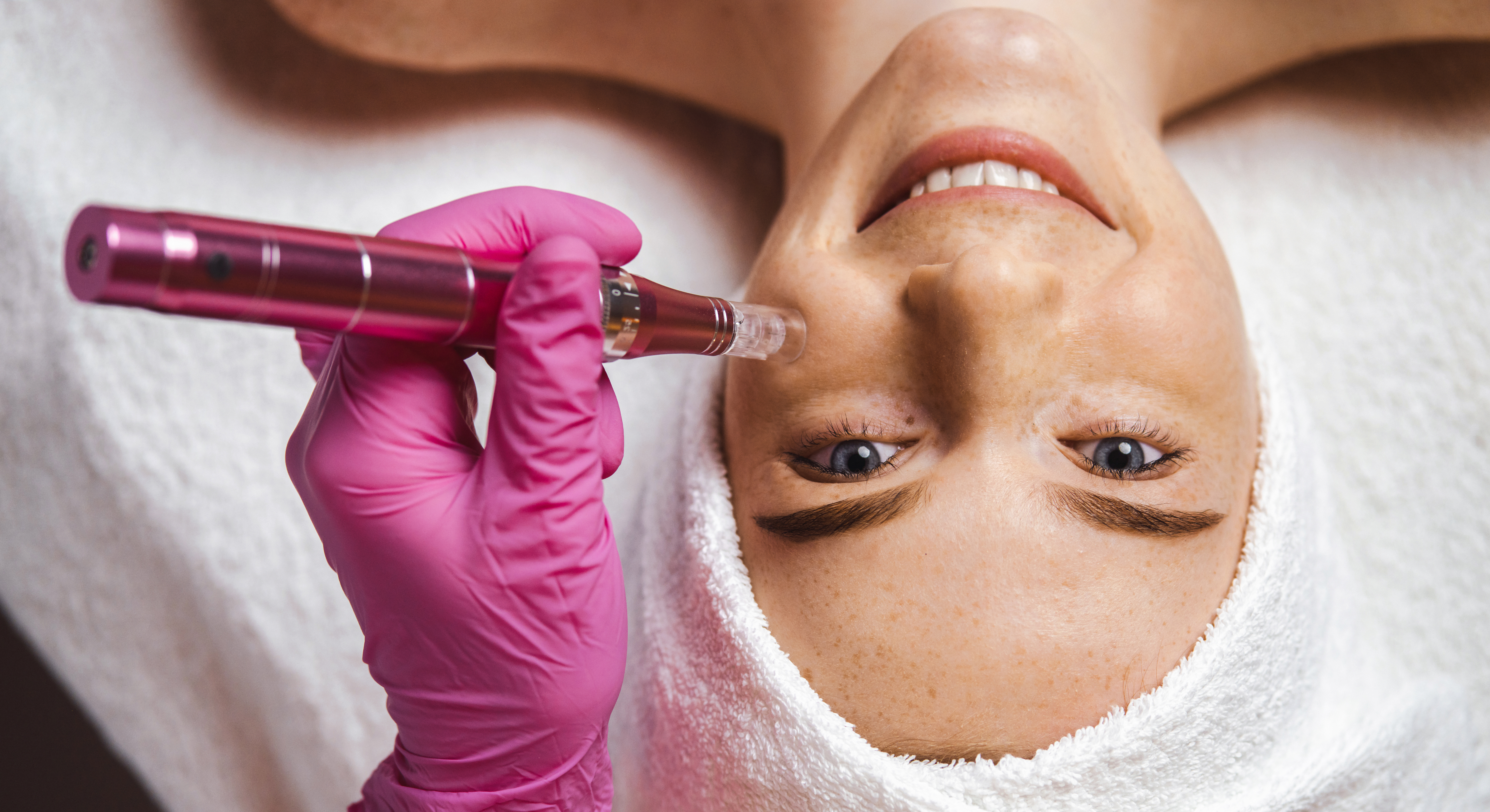 The Sculpt Clinic Microneedling Service